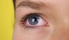 رتینوپاتی دیابتی چیست؟ علل، راهکارهای پیشگیری، درمان
